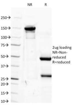 IGF-I Mouse, Clone: M23, Novus Biologicals 0.2mg; Unlabeled:Antibodies,